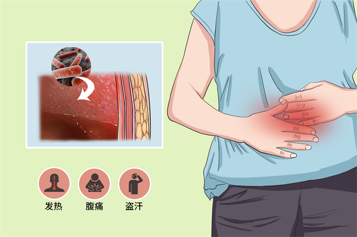 腹膜炎