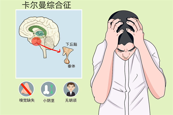 卡尔曼综合征.png