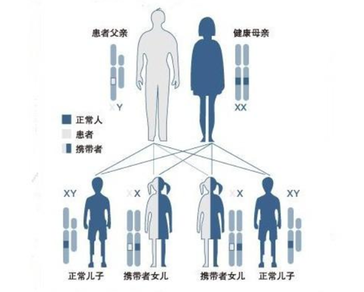 家族遗传