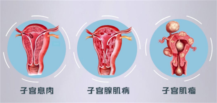 子宫因素
