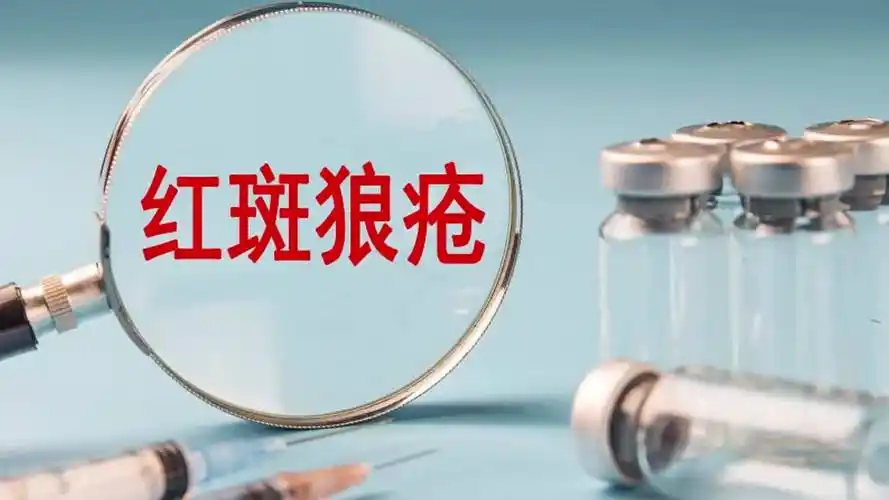 红斑狼疮