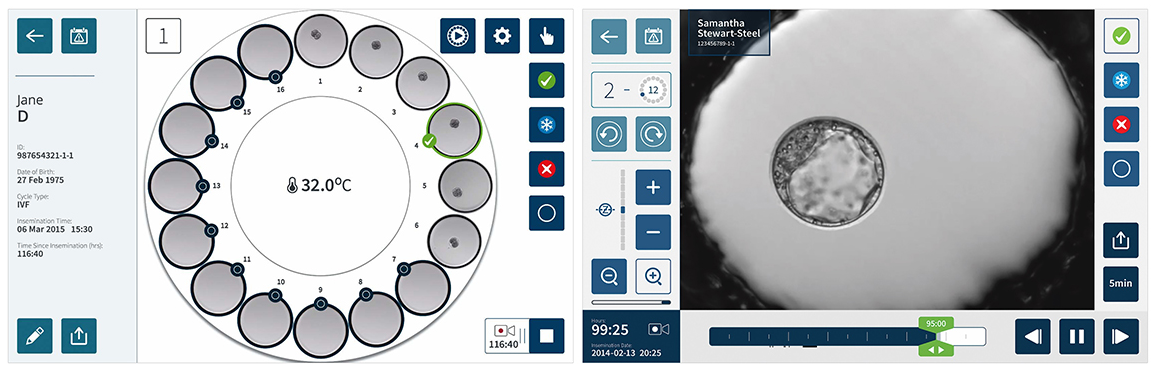 Geri® 时序培养系统