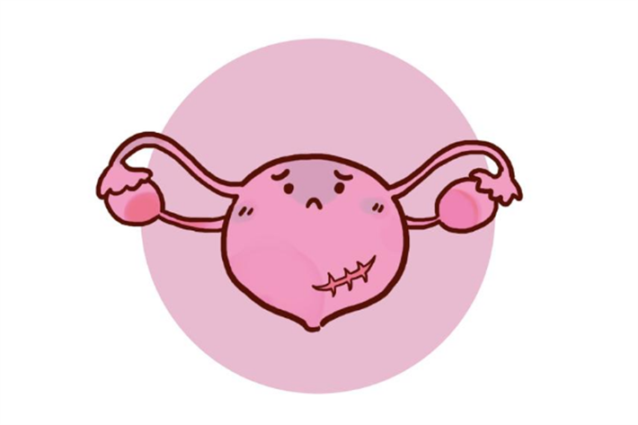 瘢痕子宫.png