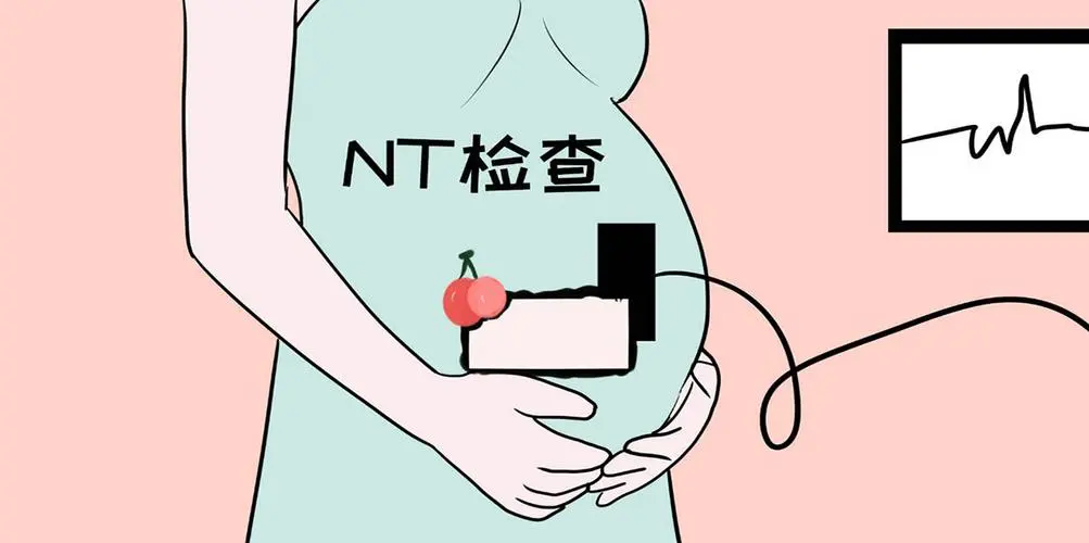 NT检查