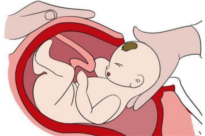 怀孕剖腹产
