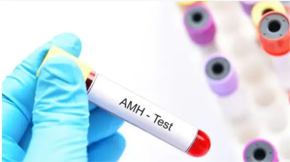 AMH