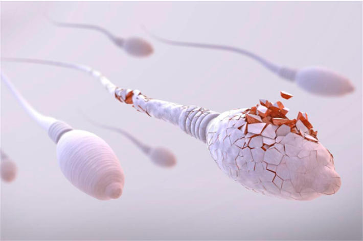 精子质量欠佳