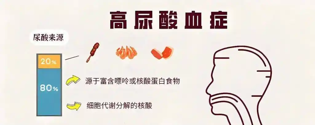 高尿酸血症