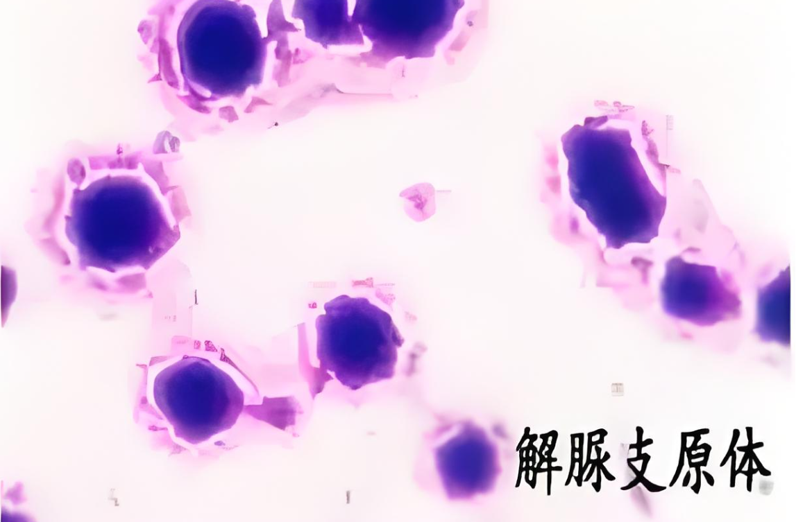 解脲支原体