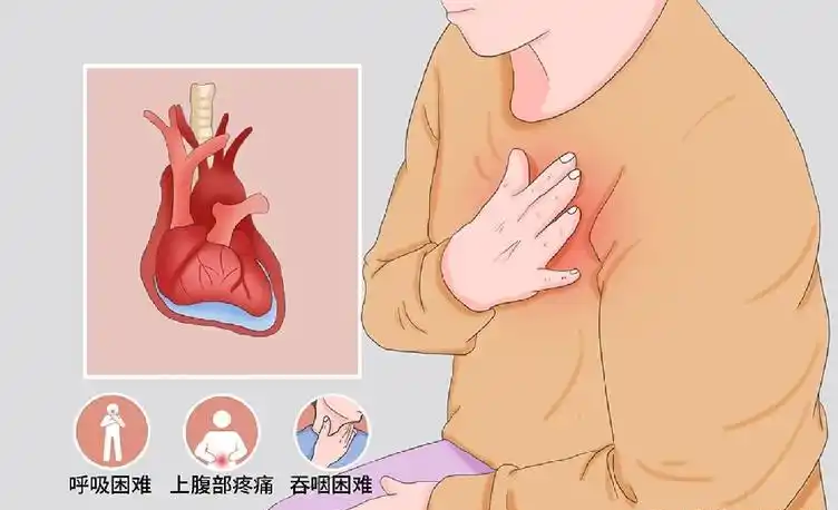 心包积液