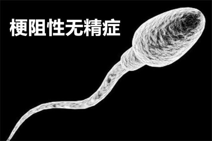 梗阻性无精