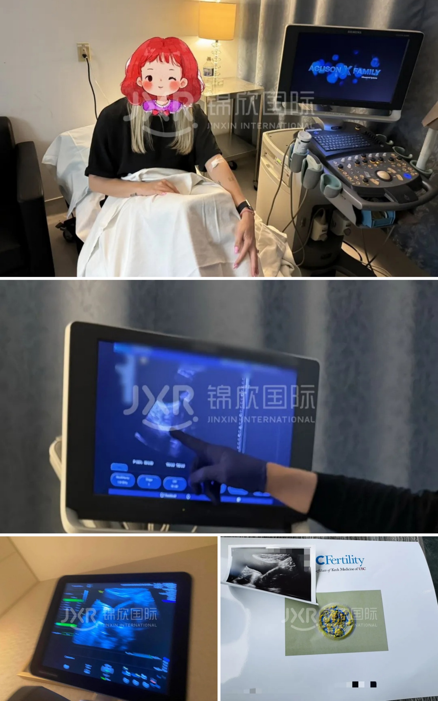 现场实况