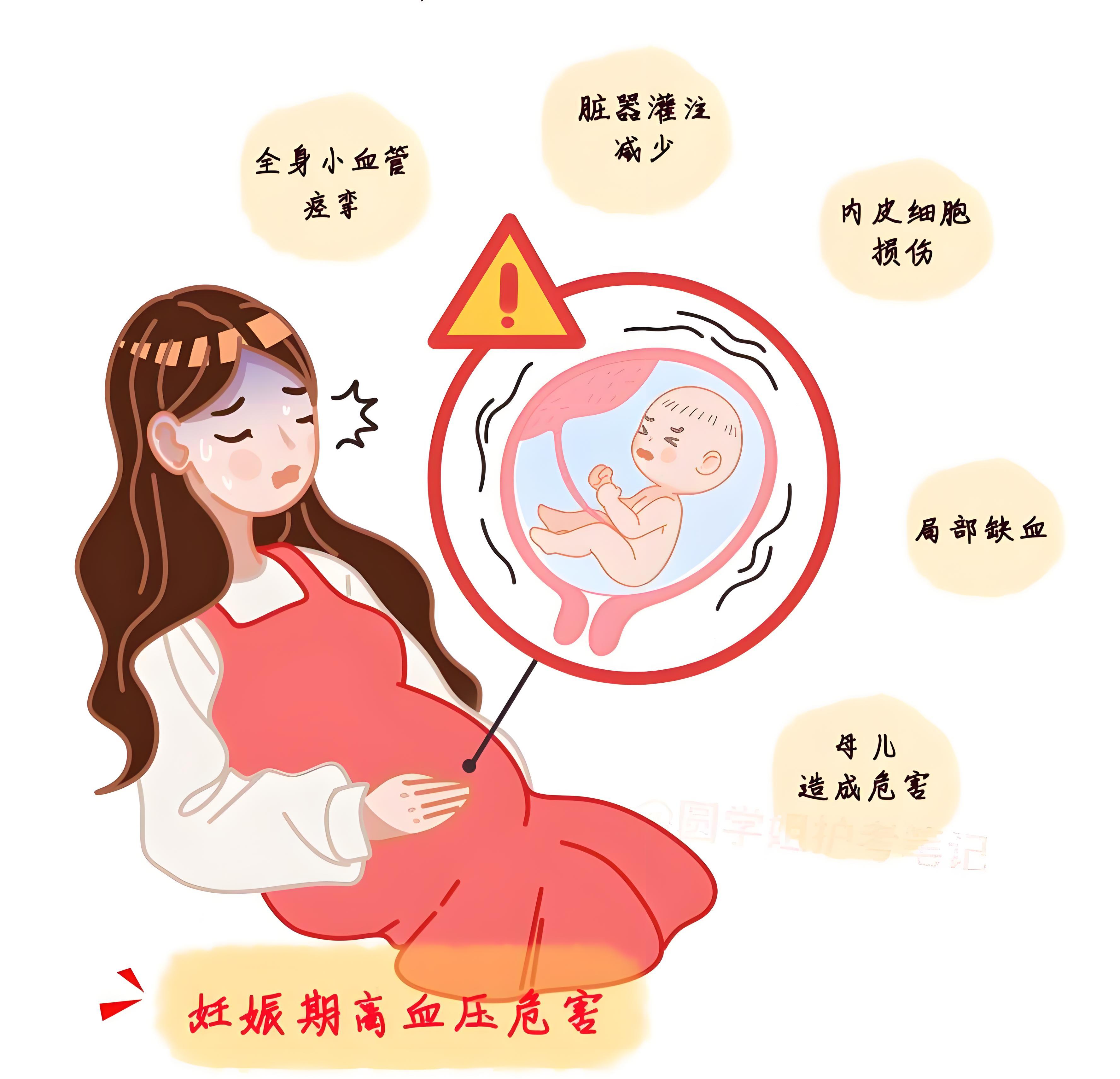 妊娠高血压