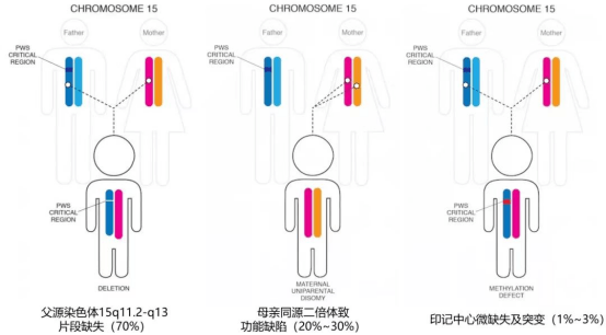 15号染色体缺失