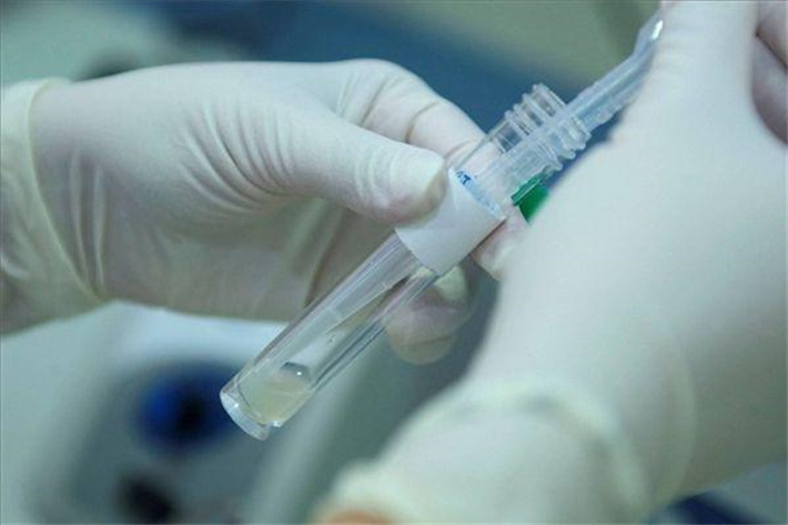 精子检查分析