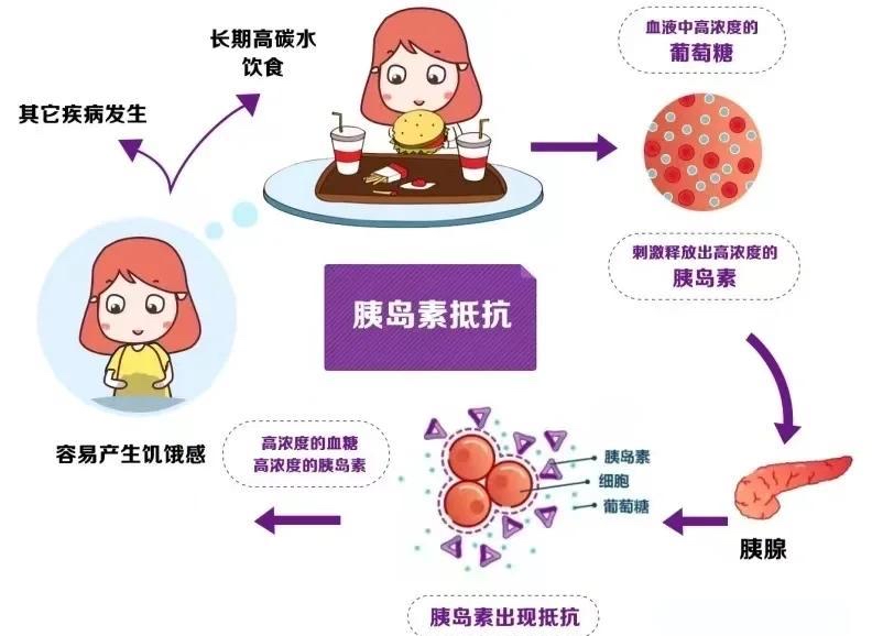 胰岛素抵抗